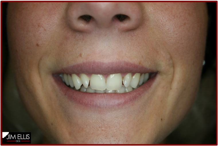 BEFORE Ogden Cosmetic Dentistry Magic