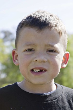 Child's tooth is missing