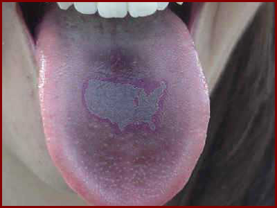 Geographic Tongue (edited)