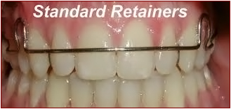 Standard Retainers - Ogden Dentist