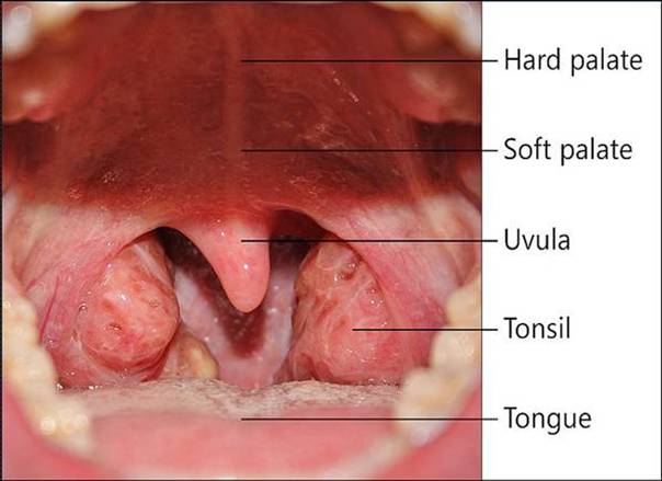 The tonsils and parts of the throat