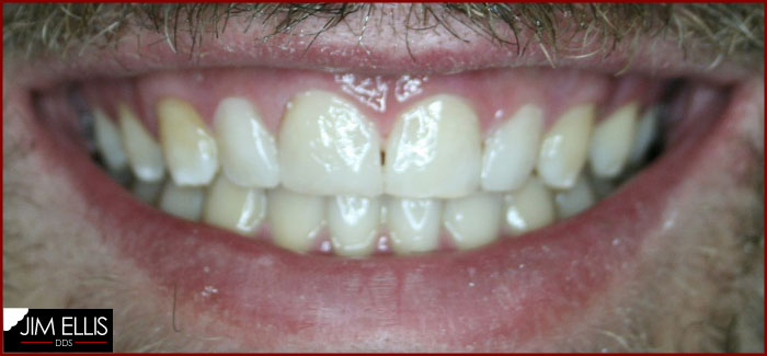 AFTER Cosmetic Dentistry 