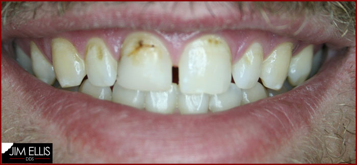 BEFORE Cosmetic Dentistry 